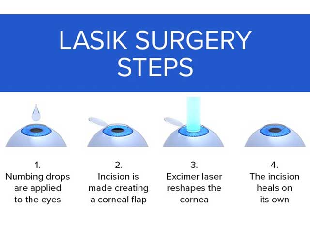 Laser Eye Surgery: Types, Cost, Side Effects, and Lasik Treatment